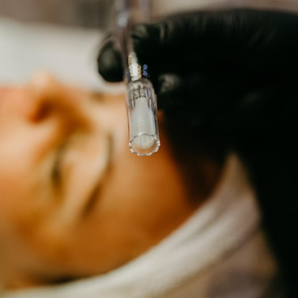 Needling needling