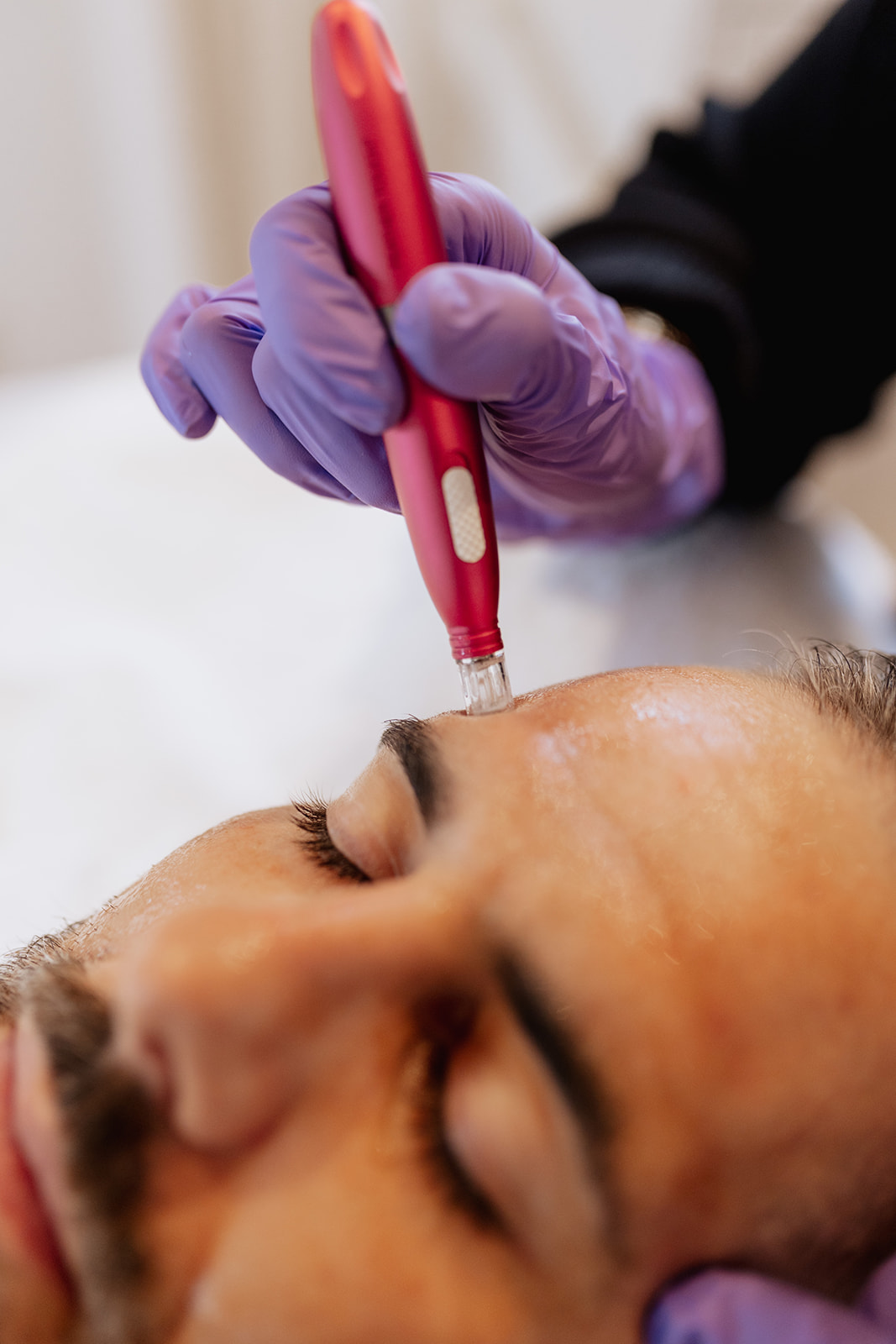 DNA Peel